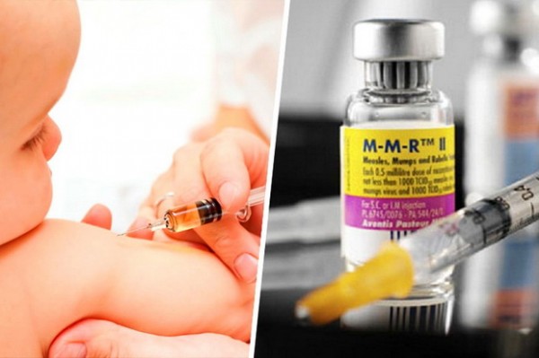 vakcinacija- dete- vakcine- mmr